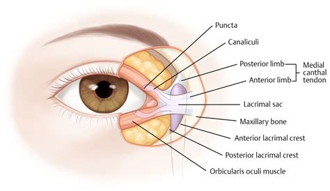 5 Canalicular Laceration and Medial Canthal Tendon Avulsion Repair ...