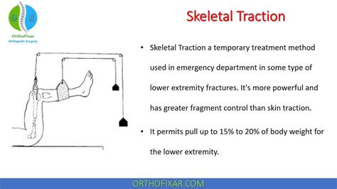 Skeletal Traction Types & Indications | OrthoFixar 2024