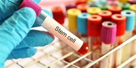 What Are Stem Cells? And What Are the Benefits of Stem Cell Banking ...