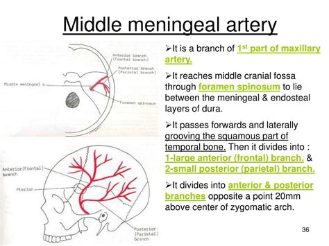 Middle Meningeal Arteries