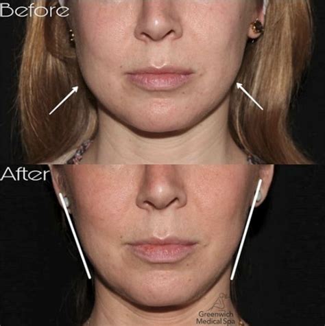 Dr Rachel Levine Before Surgery