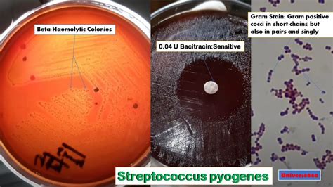 Streptococcus pyogenes: Introduction, Morphology, Culture Characteri