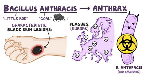 Bacillus anthracis (Anthrax): Video & Anatomy | Osmosis