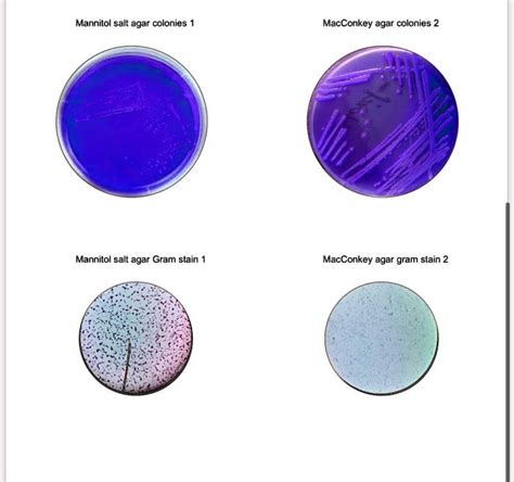 SOLVED: Gram-negative possibilities: Interpretation of results ...