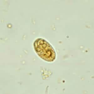 Giardia Lamblia Cyst Under Microscope | Bruin Blog