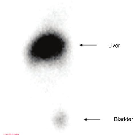 Radionuclide image in group A. | Download Scientific Diagram