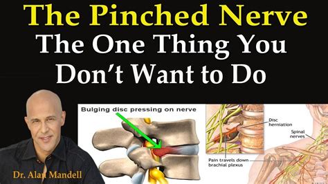 +21 How To Release A Pinched Nerve In Shoulder And Neck 2022