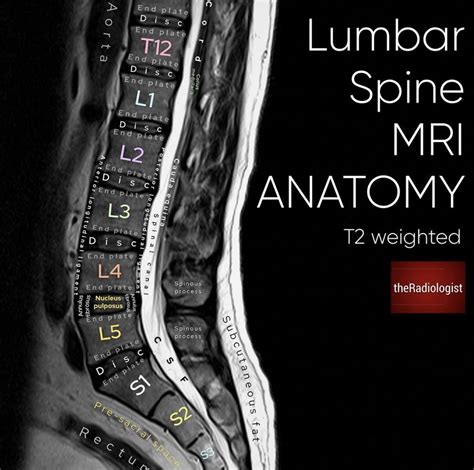 Lumbar MRI Anatomy