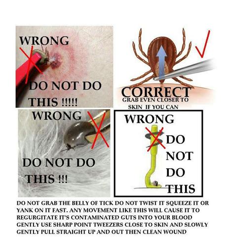 Proper tick removal - it makes a difference! | Ticks, Survival life ...