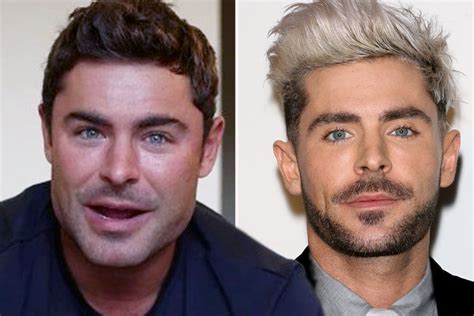 Zac Efron's fans suspect he got plastic surgery as his face looks ...