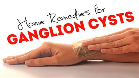 5 Home Remedies for Ganglion Cysts | By Top 5. - YouTube