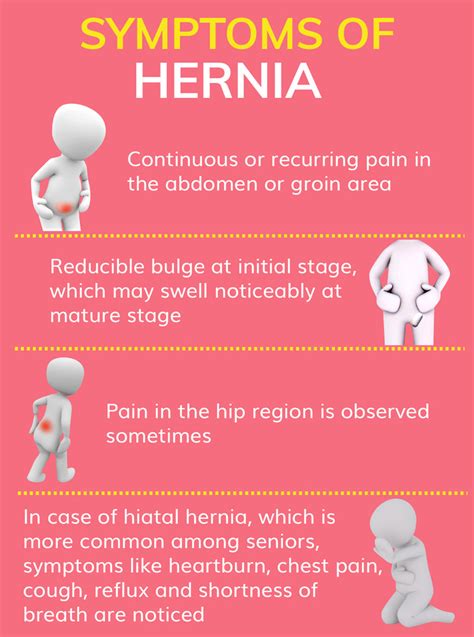 Hernia Infographic