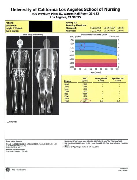 My DEXA Scan for Body Composition - BJJ Caveman