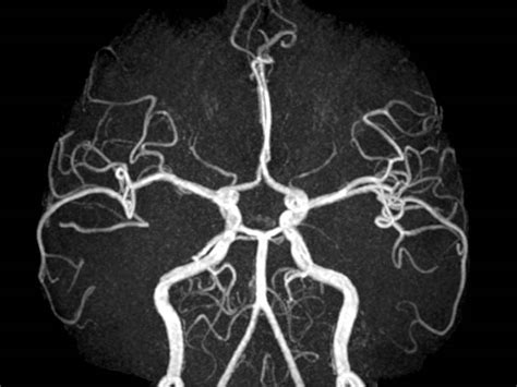 MRI / MRA Services At Desert Imaging