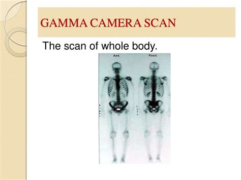 Gamma Camera