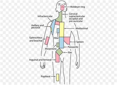 External Iliac Lymph Nodes Internal Iliac Lymph Nodes Common Iliac ...