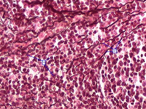 Connective Tissue Lymph Nodes