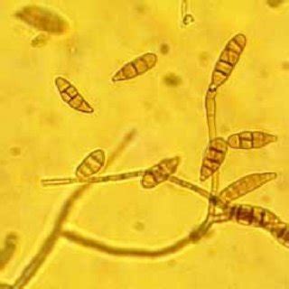 (A) Gross morphology of Trichosporon species showing cream-colored ...