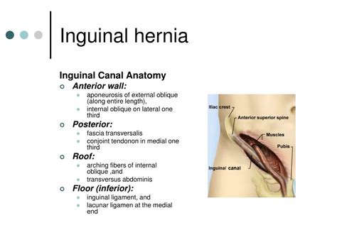 PPT - HERNIAS PowerPoint Presentation - ID:679255