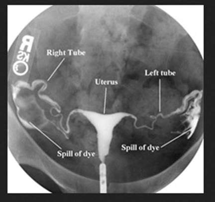 Pin on Pregnancy and Fertility