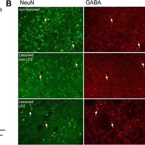 Sampling lateral geniculate nucleus (LGN) for neuronal counting. Right ...