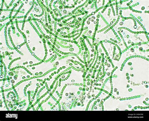 Nostoc Under Microscope Labelled