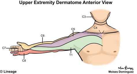 Upper Limb Neuro Dermatomes - Dermatomes Chart and Map