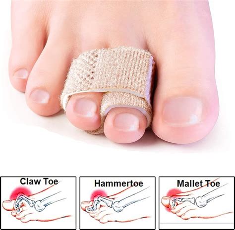 8 Pcs Hammer Toe Straightener, Hammer Toe Splints, Hammer Toe ...