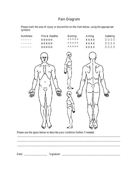 Diagram Of Shoulder Pain / SHOULDER PAIN | Proper Bench Press Form ...