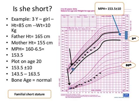 Basic approach on short stature in children