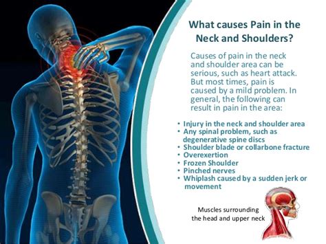 Welcome to Finerish's Blog: What are the causes of shoulder and neck pain?