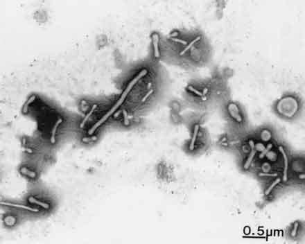 Different Size, Shape and Arrangement of Bacterial Cells