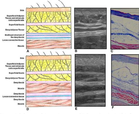 Fascia: Meet your body's fashionable "new" organ -- Health & Wellness ...