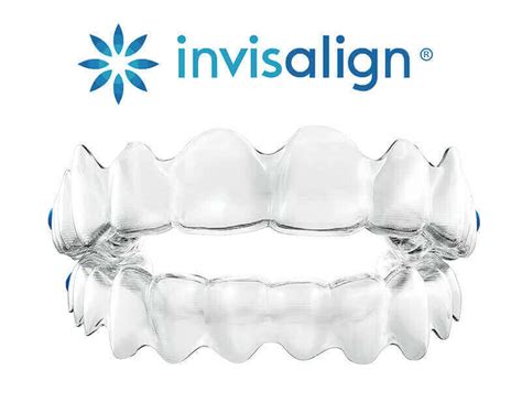 Invisalign ® Clear Aligners North York | Lu Dental - Lu Dental ...