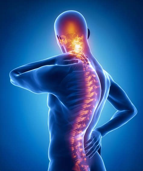 Scheuermann's Disease: Treatment in Fairfax, VA | SAPNA: Spine and Pain ...