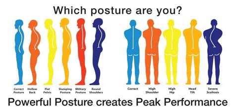 5 interesting ways to improve your posture - Dr Sam Fitzgibbons ...