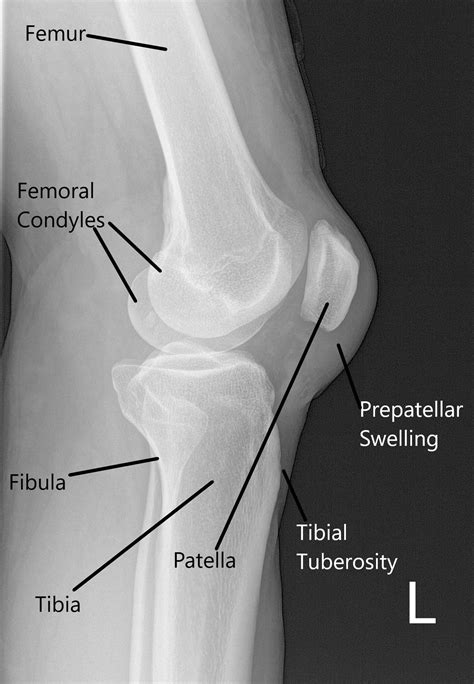 Muscles Of The Knee Labeled