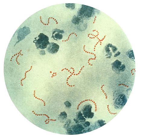 Streptococcus pyogenes: they warn of rising cases in Argentina - OiCanadian