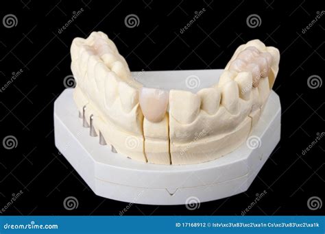 Dental wax model stock photo. Image of bridge, restoration - 17168912