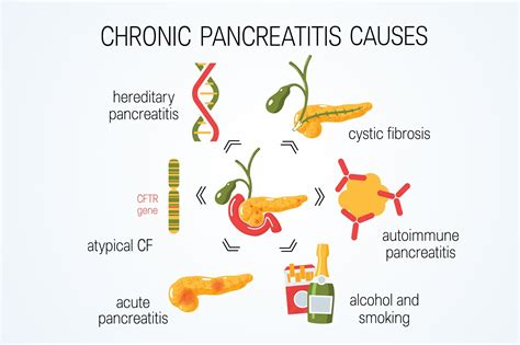 Diverse Risk Factors Associated With Calcifications in Chronic ...