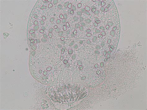 Echinococcus Granulosus Slide