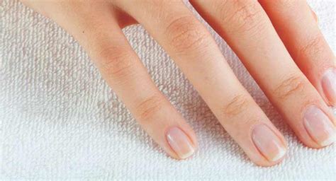 White Spots on the Nails: Causes and More