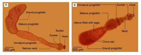 Adult Echinococcus granulosus. (A) Reared in culture media. (B ...