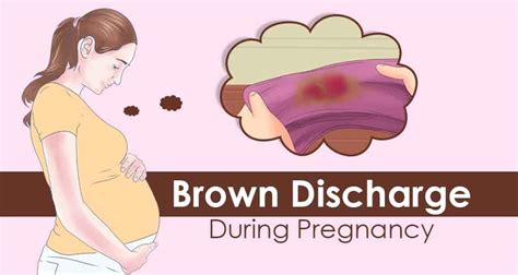 How to Stop Brown Discharge During Pregnancy? What to Do?