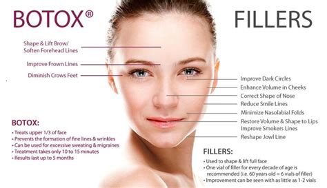 Recovery and Expectations After Botox and Dermal Fillers - SCULPTDTLA.COM