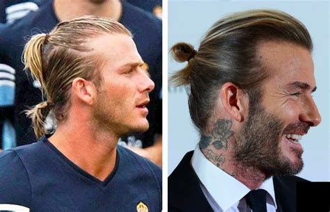 David Beckham Hair Transplant: Everything You Need To Know