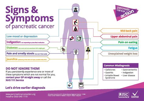 Increased awareness call for pancreatic cancer in SW | The Exeter Daily