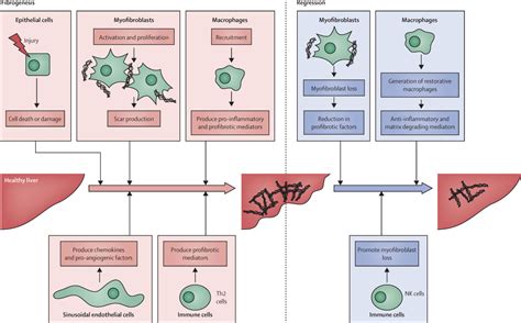 Antifibrotics in chronic liver disease: tractable targets and ...