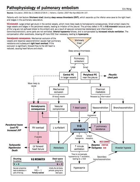 Pulmonary Embolism Causes