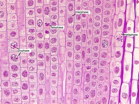 Second Onion Root Tip View with Stages of Mitosis Labeled … | Flickr